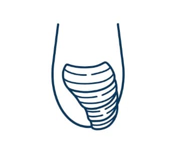 爪が厚くなっている(肥厚爪など)